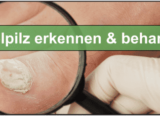 Nagelpilz – das können Sie dagegen tun! Nagelpilz erkennen, behandeln, mittel