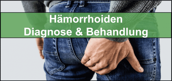 Hämorrhoiden – Symptome und Ursachen