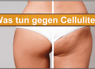 Cellulite : Ursachen und Lösung + 10 Sofort-Tipps gegen die Orangenhaut Cellulite Titelbild