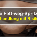 Fett weg Spritze – Erfahrungen, Test & Bewertung 2022 Fett-weg-spritze titelbild