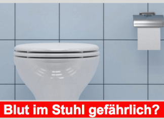 Blut im Stuhl – Ursachen und Behandlungsmöglichkeiten Blut im Stuhl