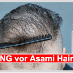 Asami – Erfahrungen, Test & Bewertungen 2022 Asami Hair Growth Titelbild