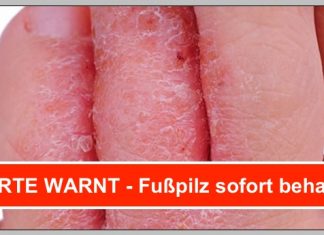 EXPERTE WARNT! ▷ Fußpilz UNBEDINGT SOFORT behandeln, sonst…