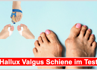 Hallux Valgus Schiene Test: 10 Hallux Valgus Schiene Hersteller im Vergleich Hallux Valgus Schiene Test Beitragsbild