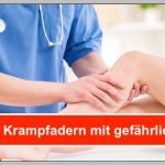 ACHTUNG! ᐅ Krampfadern mit GEFÄHRLICHEN FOLGEN, wenn…