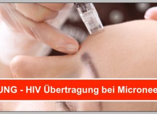 ACHTUNG! ▷ Microneedling – HIV Übertragung möglich, wenn die…
