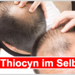 Thiocyn – Erfahrungen, Test & Bewertung 2022 Thiocyn Beitragsbild