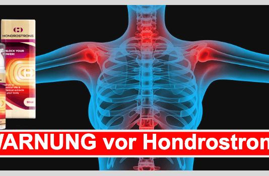 Hondrostrong – Erfahrungen, Test & Bewertung 2022