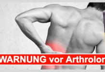 Arthrolon – Erfahrungen, Test & Bewertung 2022 Arthrolon Titelbild