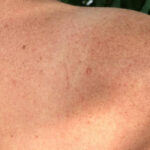 Das größte Organ der Menschen Haut
